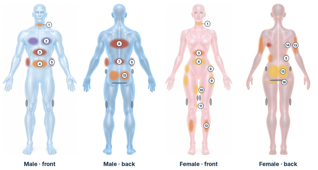 Male and female body maps showing liposuction fat zones by tissue texture and zones of adherence